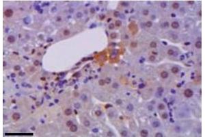 Representative immunohistochemistry of HM GB1 (brown) in liver during hepatitis.
