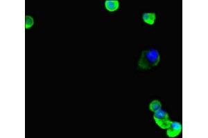 Immunofluorescent analysis of MCF-7 cells using ABIN7173691 at dilution of 1:100 and Alexa Fluor 488-congugated AffiniPure Goat Anti-Rabbit IgG(H+L)