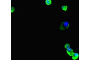 Immunofluorescent analysis of MCF-7 cells using ABIN7173691 at dilution of 1:100 and Alexa Fluor 488-congugated AffiniPure Goat Anti-Rabbit IgG(H+L) (TUBB4 anticorps  (AA 1-444))
