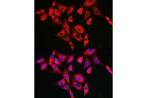 Immunofluorescence analysis of NIH/3T3 cells using NLRP2 Rabbit pAb (ABIN7268939) at dilution of 1:100 (40x lens).