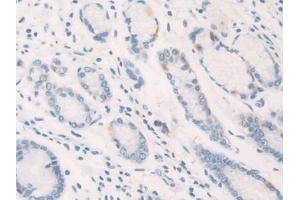 Detection of IL12A in Human Stomach Tissue using Polyclonal Antibody to Interleukin 12A (IL12A)