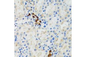 Immunohistochemistry of paraffin-embedded mouse kidney using GABARAP antibody.