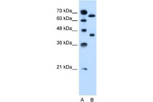 WB Suggested Anti-SLCO1A2 Antibody Titration:  0. (SLCO1A2 anticorps  (Middle Region))