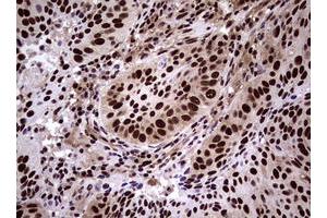 Image no. 11 for anti-Nibrin (NBN) (AA 183-460) antibody (ABIN1491058)