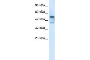 WB Suggested Anti-CHST4 Antibody Titration:  1. (CHST4 anticorps  (Middle Region))