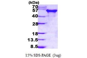 SDS-PAGE (SDS) image for tau Protein (AA 1-383) protein (His tag) (ABIN7279235) (tau Protein (AA 1-383) (His tag))