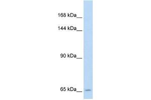 WB Suggested Anti-SLC19A1 Antibody Titration:  5. (SLC19A1 anticorps  (N-Term))