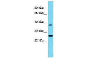Host:  Rabbit  Target Name:  Neurog1  Sample Type:  Rat Testis lysates  Antibody Dilution:  1. (Neurogenin 1 anticorps  (Middle Region))