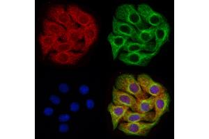 ABIN7094535 and ABIN7098584 staining Hela cells by IF/ICC. (APH1A anticorps  (C-Term))