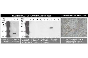 Immunohistochemistry (IHC) image for anti-Cytochrome P450, Family 3, Subfamily A, Polypeptide 5 (CYP3A5) (C-Term) antibody (ABIN264500)