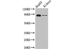 Western Blot Positive WB detected in: HepG2 whole cell lysate, Mouse kidney tissue All lanes: CPT1A antibody at 3. (CPT1A anticorps  (AA 301-600))