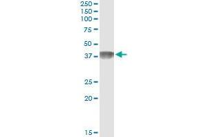 Immunoprecipitation of C4BPB transfected lysate using anti-C4BPB monoclonal antibody and Protein A Magnetic Bead , and immunoblotted with C4BPB MaxPab rabbit polyclonal antibody.