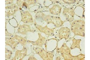 Immunohistochemistry of paraffin-embedded human kidney using  in 30 μg/mL dilute concentrations. (CD14 anticorps)