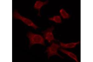 ABIN6276103 staining COLO205 by IF/ICC. (OPN4 anticorps  (C-Term))