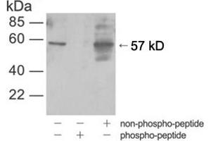 Western blot analysis of cell lysates from HEK-293 cells treated with UVusing Rabbit Anti-Akt (Phospho-Ser473) Polyclonal Antibody (ABIN398632) (AKT1 anticorps  (pSer473))