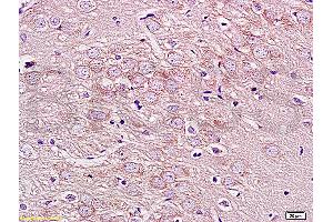 Formalin-fixed and paraffin embedded rat brain labeled with Rabbit Anti GPRIN1 Polyclonal Antibody, Unconjugated (ABIN872320) at 1:200 followed by conjugation to the secondary antibody and DAB staining (GPRIN1 anticorps  (AA 101-200))