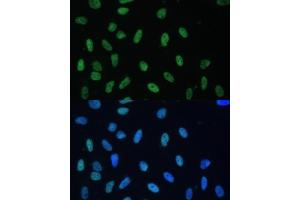 Immunofluorescence analysis of U-2 OS cells using HNRNPD antibody (ABIN7267632) at dilution of 1:100.
