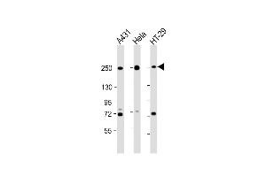 Western Blot at 1:2000 dilution Lane 1: A431 whole cell lysate Lane 2: Hela whole cell lysate Lane 3: HT-29 whole cell lysate Lysates/proteins at 20 ug per lane. (Myosin 9 anticorps  (C-Term))
