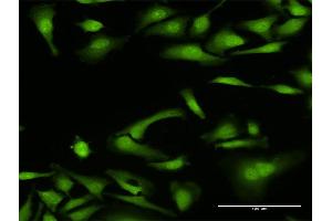 Immunofluorescence of purified MaxPab antibody to NCF4 on HeLa cell.