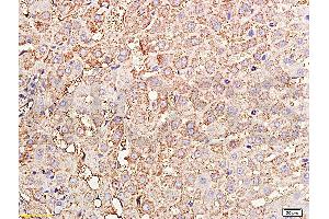 Formalin-fixed and paraffin embedded rabbit liver tissue labeled with Rabbit Anti-TIMP-1(NT) Polyclonal Antibody, Unconjugated (ABIN668331) at 1:200 followed by conjugation to the secondary antibody and DAB staining.