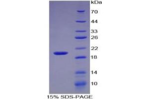 SDS-PAGE of Protein Standard from the Kit  (Highly purified E. (IL-17 Kit ELISA)