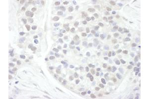 Immunohistochemistry (IHC) image for anti-Cyclin T1 (CCNT1) (AA 625-675) antibody (ABIN7453625)