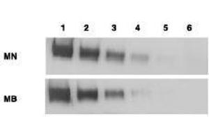 Western Blotting (WB) image for anti-Mesothelin (MSLN) (Extracellular Domain) antibody (ABIN400815) (Mesothelin anticorps  (Extracellular Domain))