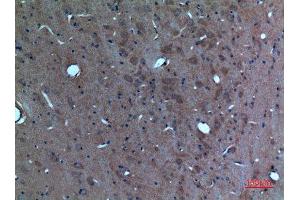 Immunohistochemistry (IHC) analysis of paraffin-embedded Rat Brain, antibody was diluted at 1:100.