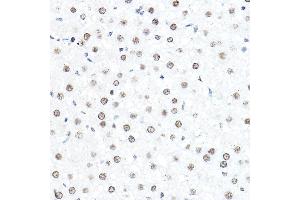Immunohistochemistry of paraffin-embedded rat liver using SP1 Rabbit pAb (ABIN7270506) at dilution of 1:50 (40x lens).