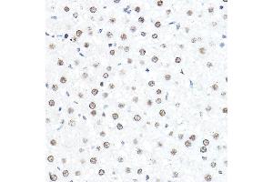 Immunohistochemistry of paraffin-embedded rat liver using SP1 Rabbit pAb (ABIN7270506) at dilution of 1:50 (40x lens). (SP1 anticorps  (AA 420-620))
