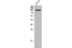 Western Blot analysis of Jurkat cells using LI-cadherin Polyclonal Antibody (LI Cadherin anticorps  (Internal Region))