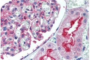 Human Kidney (formalin-fixed, paraffin-embedded) stained with ATG7 antibody ABIN305896 at 5 ug/ml followed by biotinylated goat anti-rabbit IgG secondary antibody ABIN481713, alkaline phosphatase-streptavidin and chromogen. (ATG7 anticorps  (N-Term))