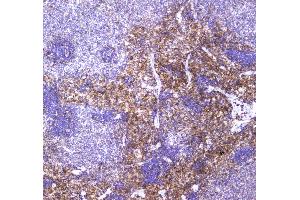 IHC analysis of VCAM1 using anti-VCAM1 antibody . (VCAM1 anticorps  (AA 25-270))