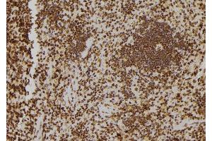 ABIN6277184 at 1/100 staining Rat spleen tissue by IHC-P. (TOLLIP anticorps  (Internal Region))
