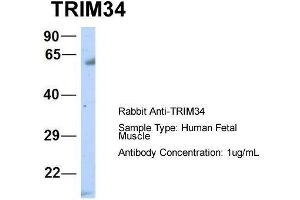 Host:  Rabbit  Target Name:  TRIM34  Sample Type:  Human Fetal Muscle  Antibody Dilution:  1. (TRIM34 anticorps  (N-Term))