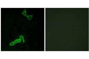 Immunofluorescence analysis of MCF-7 cells, using GPR137C antibody. (GPR137C anticorps  (Internal Region))