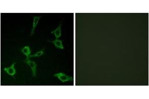 Immunofluorescence analysis of LOVO cells, using OR2AG1/2AG2 Antibody. (OR2AG1+2 (AA 61-110) anticorps)