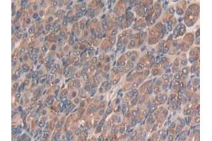 IHC-P analysis of Mouse Stomach Tissue, with DAB staining. (SLIT3 anticorps  (AA 1348-1517))