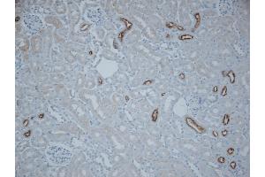 Immunohistochemistry analysis using Rabbit Anti-NCC Polyclonal Antibody (ABIN2486296).