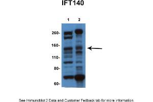 Sample Type: 1. (IFT140 anticorps  (N-Term))