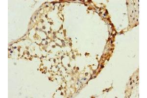 Immunohistochemistry of paraffin-embedded human testis tissue using ABIN7159905 at dilution of 1:100 (TIMM23 anticorps  (AA 1-209))