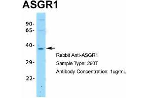 Host:  Rabbit  Target Name:  ASGR1  Sample Type:  293T  Antibody Dilution:  1.