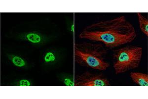 ICC/IF Image hnRNP H antibody [N1C1] detects hnRNP H protein at nucleus by immunofluorescent analysis. (HNRNPH1 anticorps)