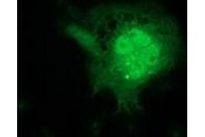 Anti-FGF21 mouse monoclonal antibody (ABIN2454488) immunofluorescent staining of COS7 cells transiently transfected by pCMV6-ENTRY FGF21 (RC204538). (FGF21 anticorps  (AA 29-209))