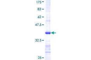 Image no. 1 for Cysteine Sulfinic Acid Decarboxylase (CSAD) (AA 1-98) protein (GST tag) (ABIN1350474)