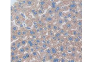 Used in DAB staining on fromalin fixed paraffin- embedded liver tissue