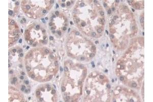 Detection of AASS in Human Kidney Tissue using Polyclonal Antibody to Aminoadipate Semialdehyde Synthase (AASS)