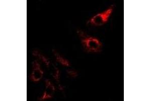 Immunofluorescent analysis of SPINK1 staining in Hela cells.