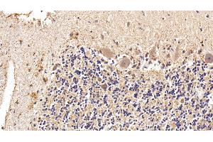 Detection of GLb in Human Cerebellum Tissue using Polyclonal Antibody to Galactosidase Beta (GLb)