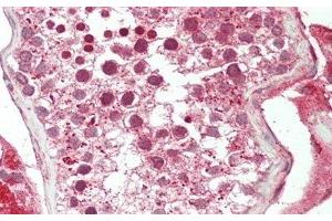 Detection of CX3CL1 in Human Testis Tissue using Polyclonal Antibody to Chemokine C-X3-C-Motif Ligand 1 (CX3CL1)